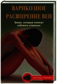 Варикозное расширение вен. Травы, которые помогут избежать операции - Подколзина Вера (книга жизни txt) 📗