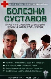 Болезни суставов - Трофимов С. (бесплатные версии книг .TXT) 📗